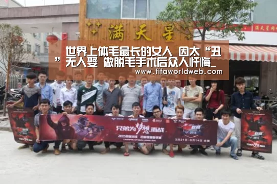 世界上体毛最长的女人 因太“丑”无人娶 做脱毛手术后众人忏悔_世界杯买球网站官网(图1) 世界杯买球网站